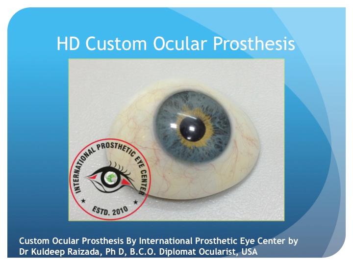 Custom Artificial Eyes - Southeastern Ocularists Inc.